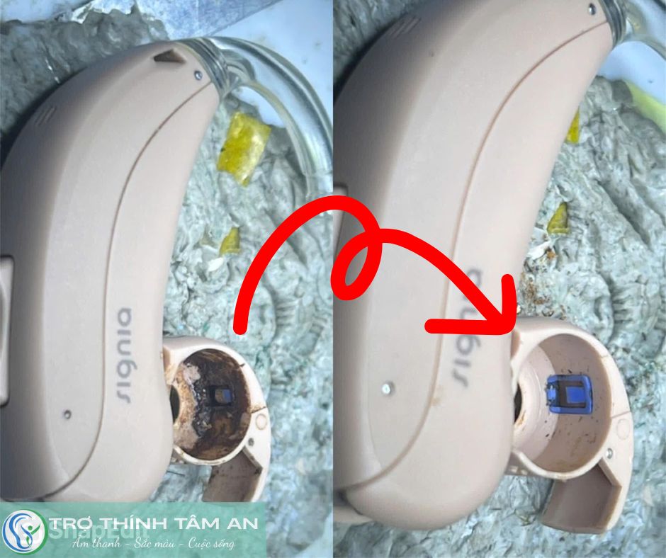 [MIỄN PHÍ] BẢO DƯỜNG MÁY TRỢ THÍNH ĐỊNH KỲ TẠ